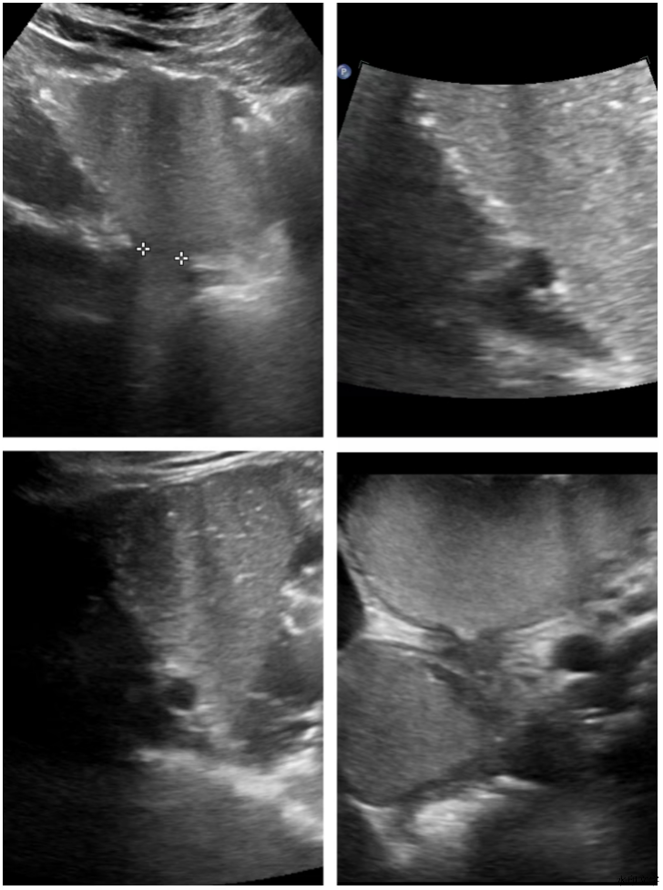 b8f3226d97644a62a3f4cd282a80241a.png b8f3226d97644a62a3f4cd282a80241a.png