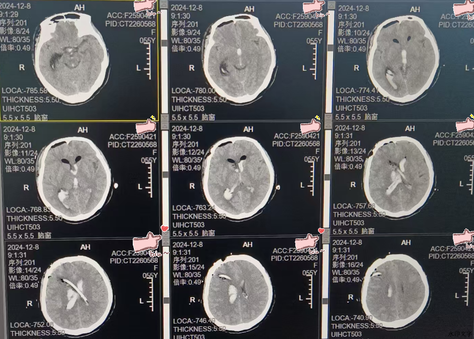 233a6d20ee6d47568243dcb756d6e489.png 233a6d20ee6d47568243dcb756d6e489.png