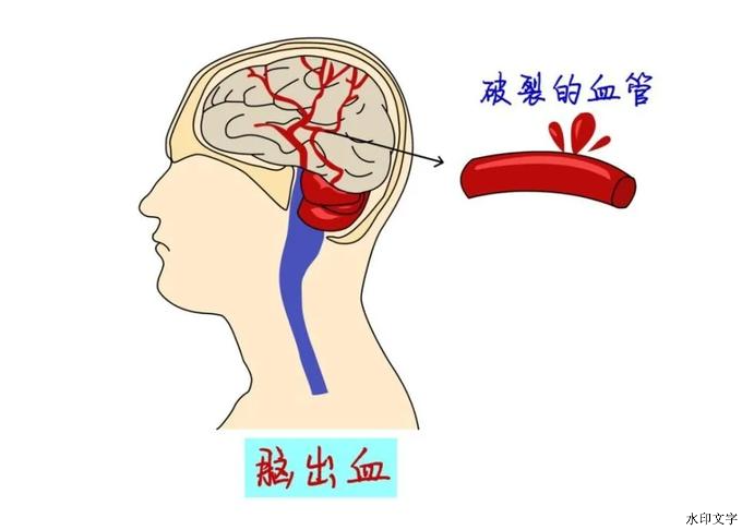 ad07e558ee7f4098af0afc265020aa9f.png ad07e558ee7f4098af0afc265020aa9f.png